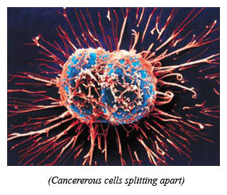 Can Herpes Simplex Virus Cause Cancer?